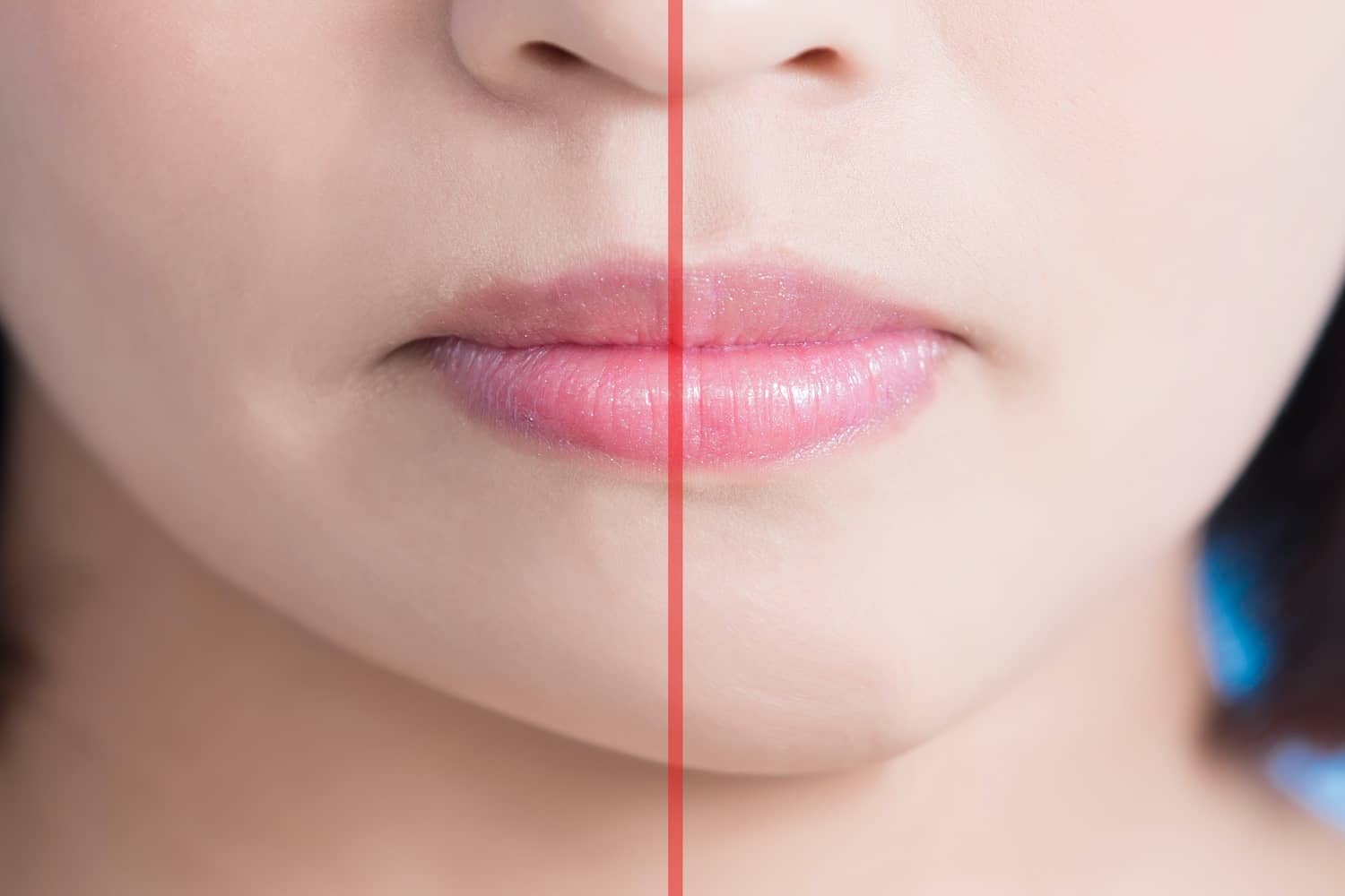 Állcsontdeformitás