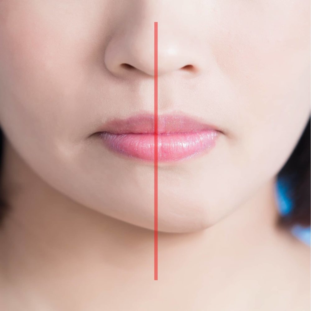 Állcsontdeformitás