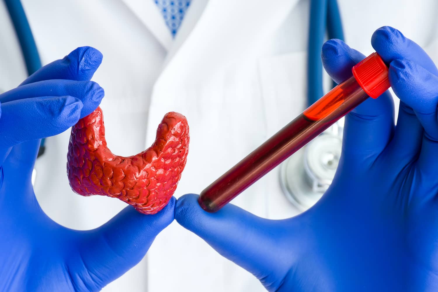 Pajzsmirigy szűrés