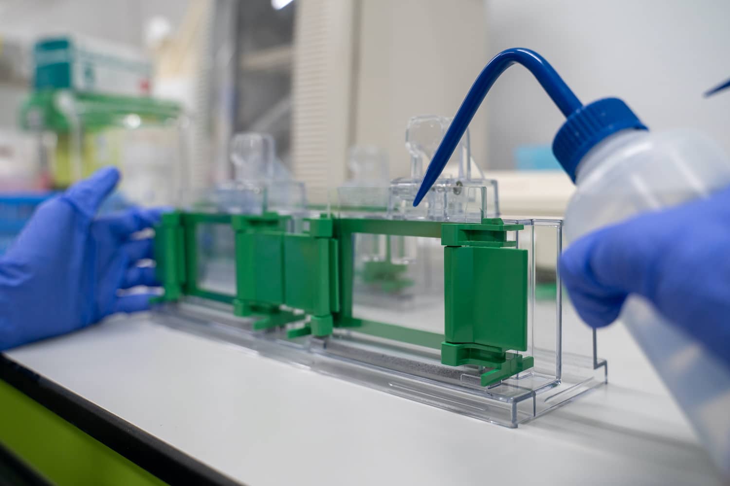 Fehérjeszint vizsgálat