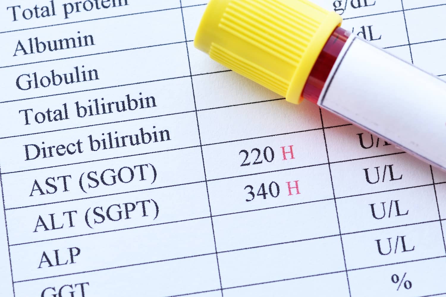 Májfunkció vizsgálat