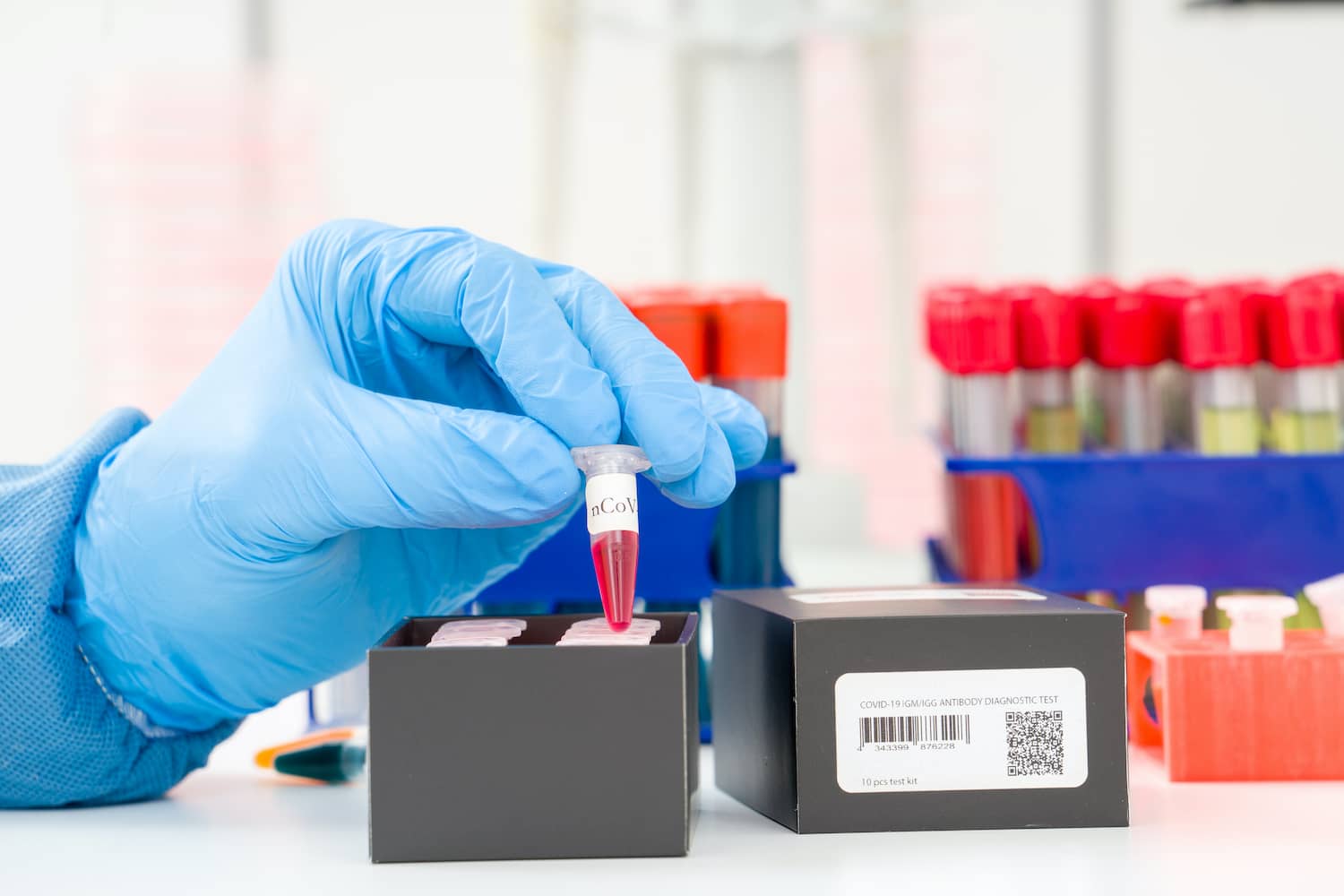 Szerológiai vizsgálat