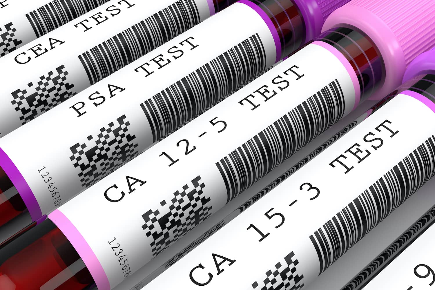 Tumormarker vizsgálat