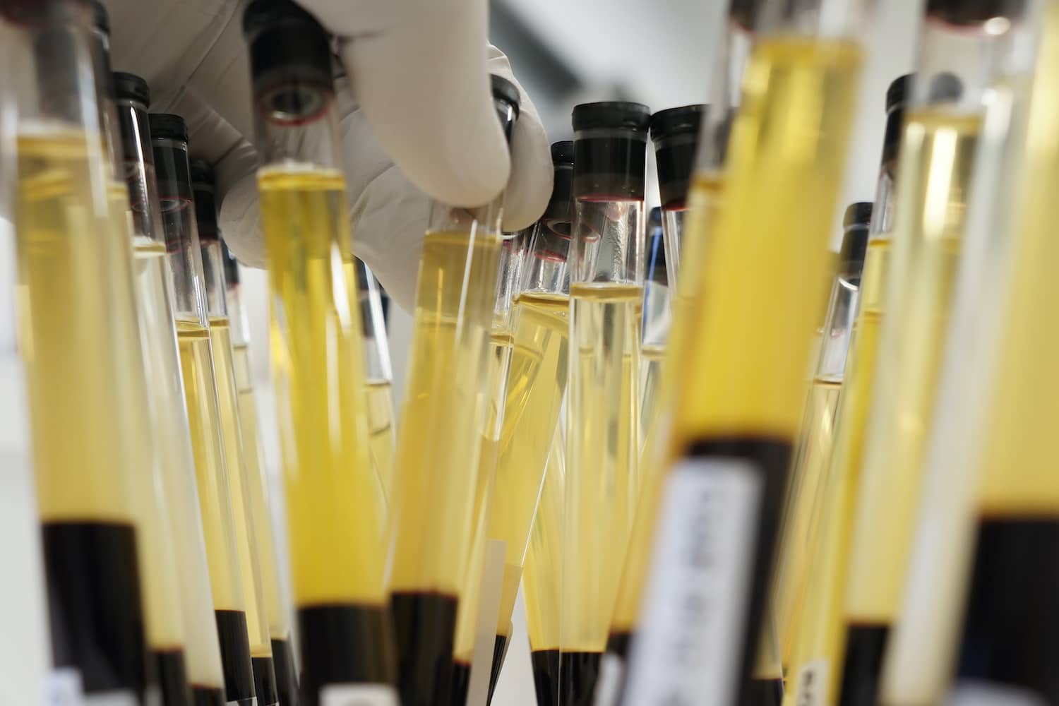 Vérkép, véralvadás