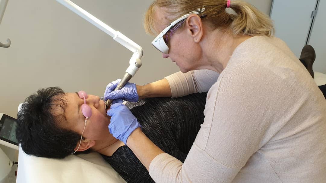 NightLase horkolásgátló kezelés NightLase horkolásgátló kezelés