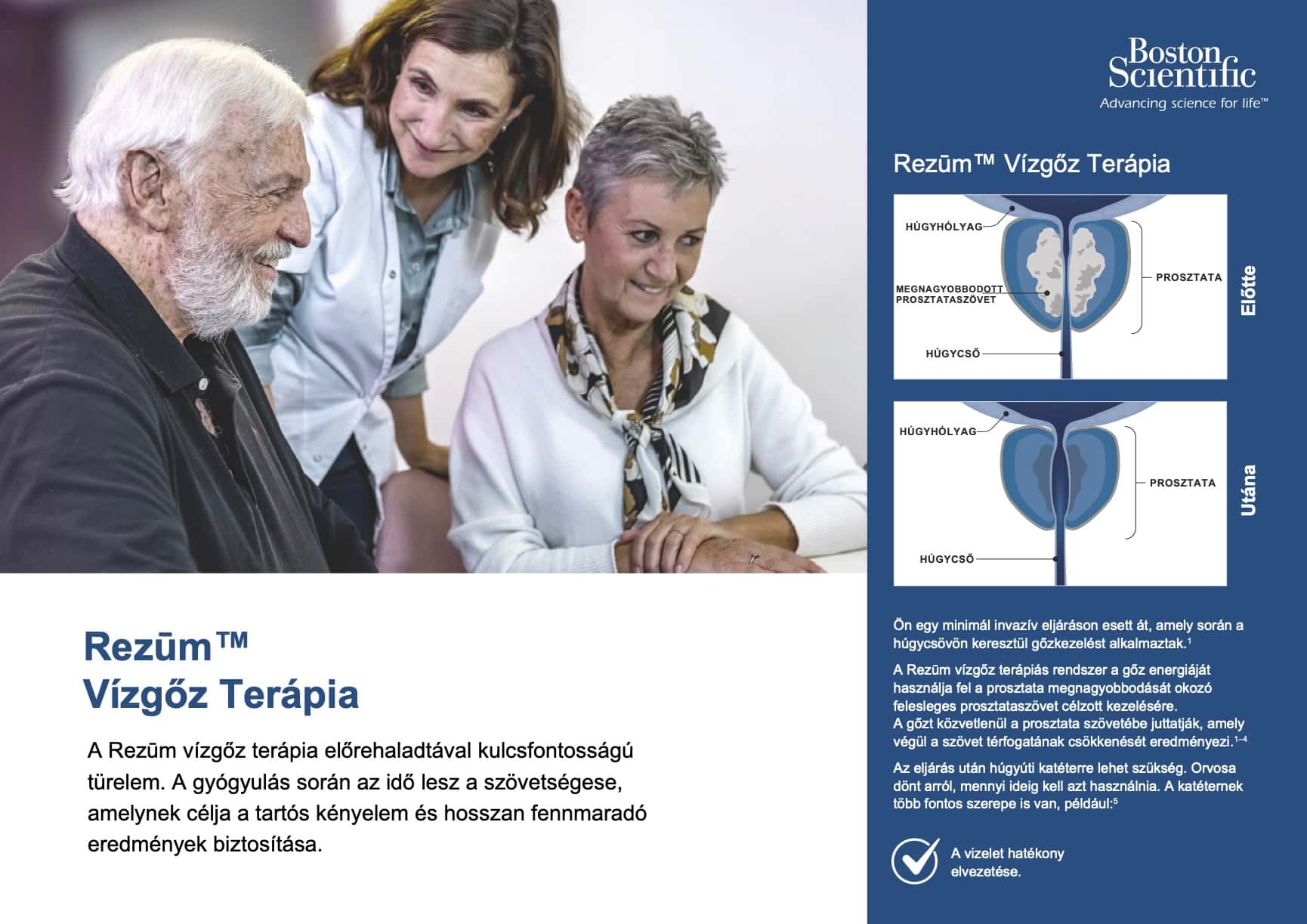 Rezüm vízgőz terápia brossúra