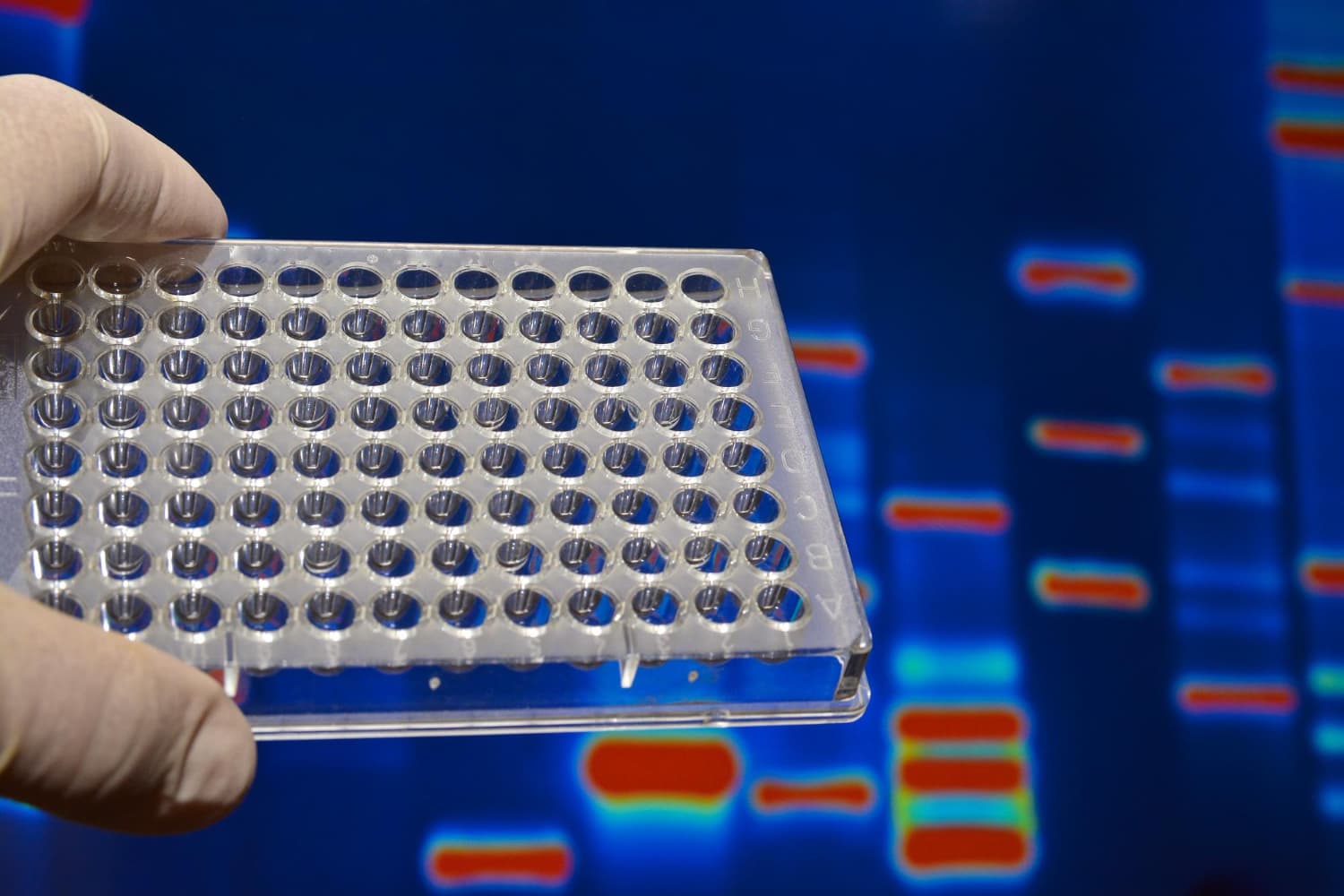 Pajzsmirigy molekuláris diagnosztika