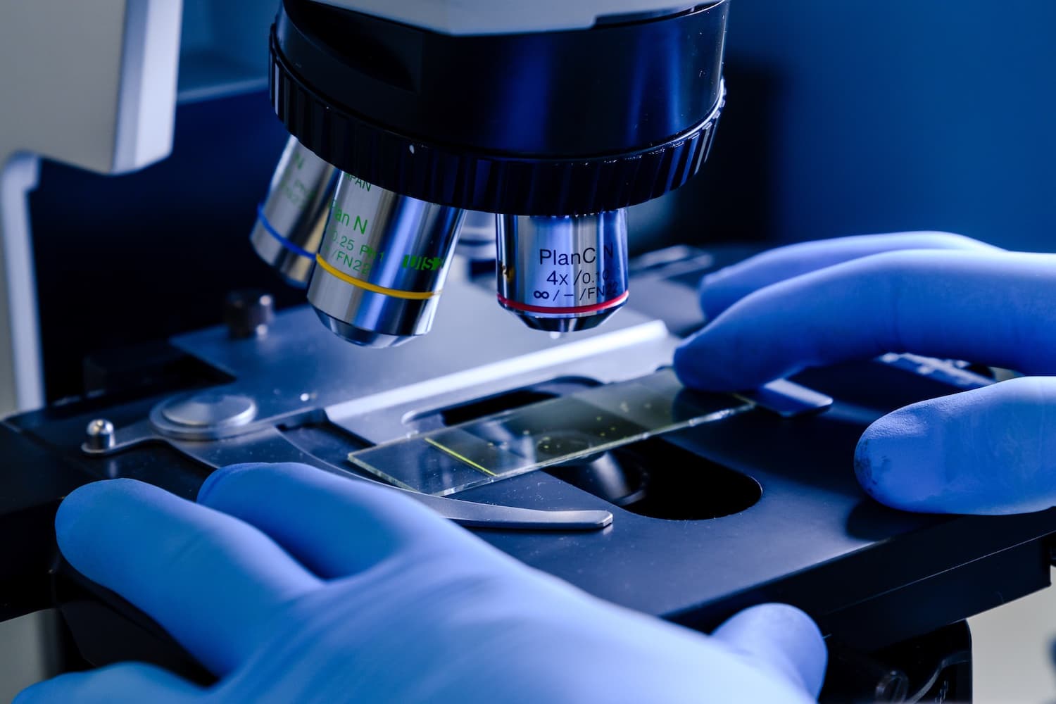 Pajzsmirigy patológia